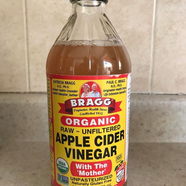 Vinegar Dandruff Cure