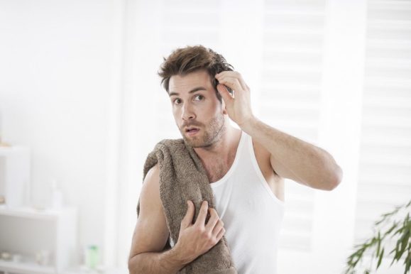 10 Tips on How to Cope With Bald Spot – Always Remain Attractive